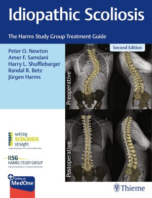 Idiopathic Scoliosis – The Harms Study Group Treatment Guide