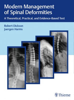 Modern Management of Spinal Deformities – A Theoretical, Practical, and Evidence-Based Text